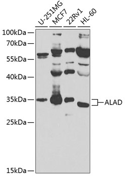 Anti-ALAD Antibody
