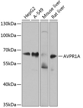 Anti-AVPR1A / V1aR Antibody