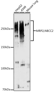 Anti-MRP2 Antibody