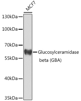 Anti-GBA Antibody