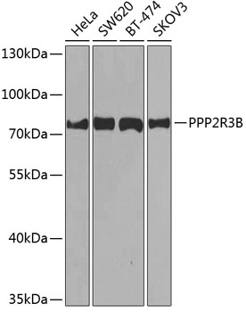 Anti-PPP2R3B Antibody