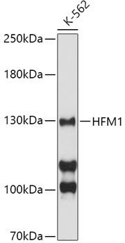 Anti-HFM1 Antibody