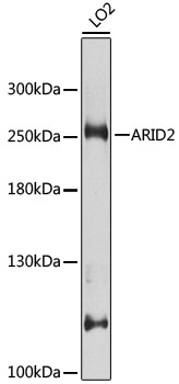 Anti-ARID2 Antibody