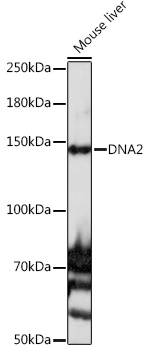 Anti-DNA2 Antibody