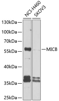 Anti-MICB Antibody