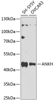 Anti-ANKH Antibody