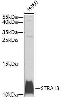 Anti-MHF2 Antibody