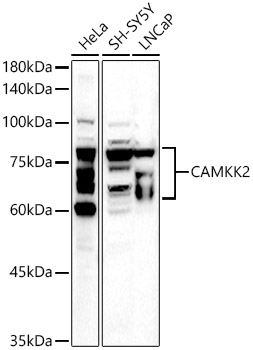 Anti-CAMKK2 Antibody