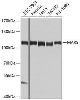 Anti-MetRS / MARS Antibody