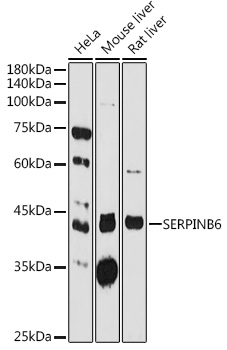 Anti-SerpinB6 / CAP Antibody
