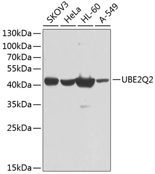 Anti-UBE2Q2 Antibody