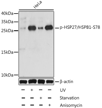 Anti-Hsp27 (phospho Ser78) Antibody - Identical to Abcam (ab194773)