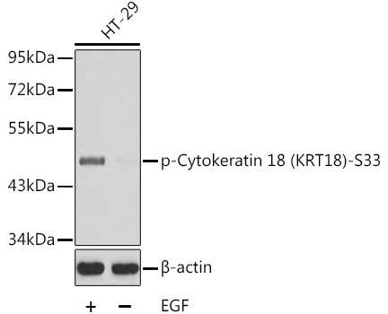 Anti-Cytokeratin 18 (phospho Ser33) Antibody