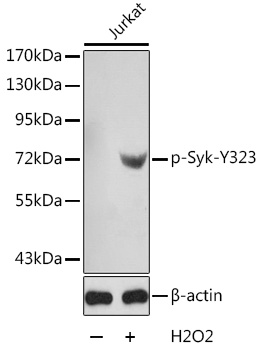Anti-Syk (phospho Tyr323) Antibody - Identical to Abcam (ab194852)