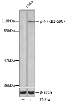 Anti-NFkB p105 / p50 (phospho Ser907) Antibody