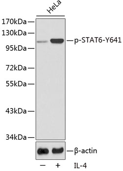 Anti-STAT6 (phospho Tyr641) Antibody