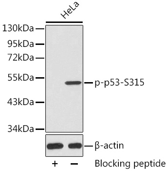 Anti-p53 (phospho Ser315) Antibody