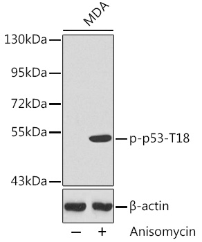 Anti-p53 (phospho Thr18) Antibody