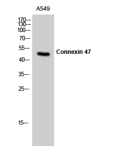 Anti-CXG2 Antibody Anti-CXG2 Antibody
