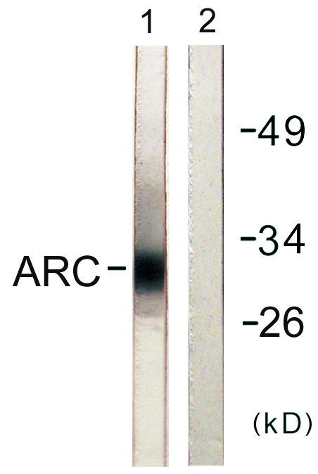 Anti-ARC Antibody