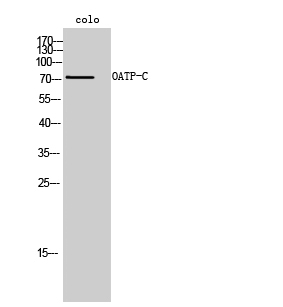 Anti-SLCO1B1 Antibody