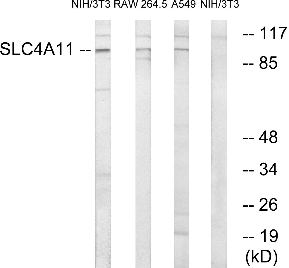 Anti-SLC4A11 Antibody