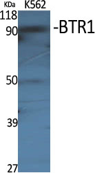 Anti-SLC4A11 Antibody Anti-SLC4A11 Antibody