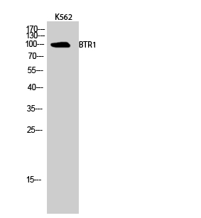 Anti-SLC4A11 Antibody Anti-SLC4A11 Antibody