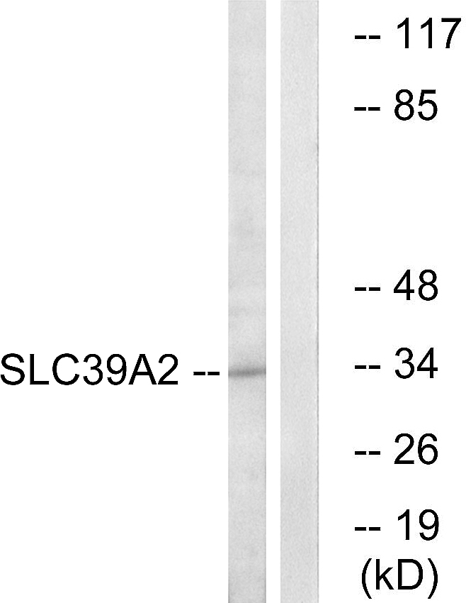 Anti-SLC39A2 Antibody
