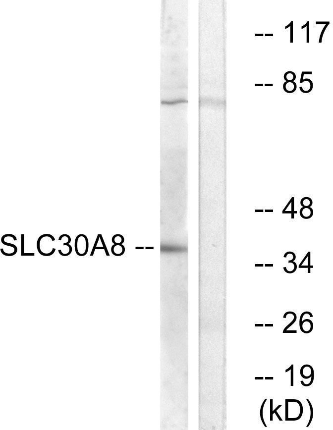 Anti-SLC30A8 Antibody