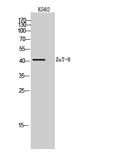 Anti-SLC30A8 Antibody Anti-SLC30A8 Antibody