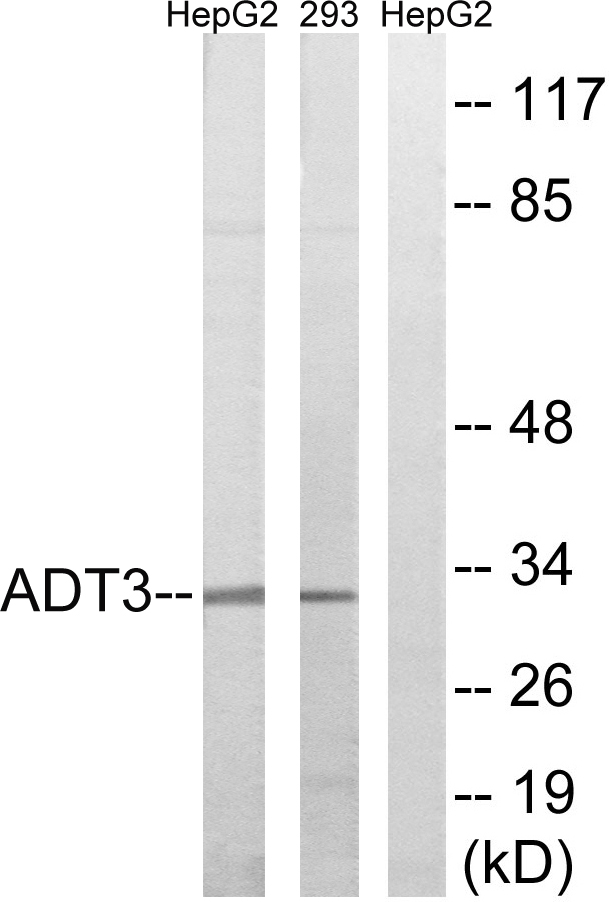 Anti-SLC25A6 Antibody