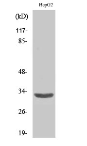 Anti-SLC25A6 Antibody Anti-SLC25A6 Antibody
