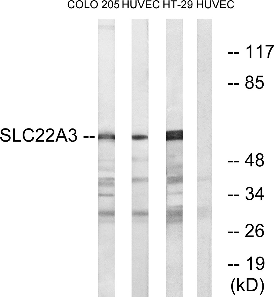 Anti-SLC22A3 Antibody