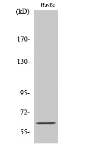 Anti-SLC22A3 Antibody Anti-SLC22A3 Antibody