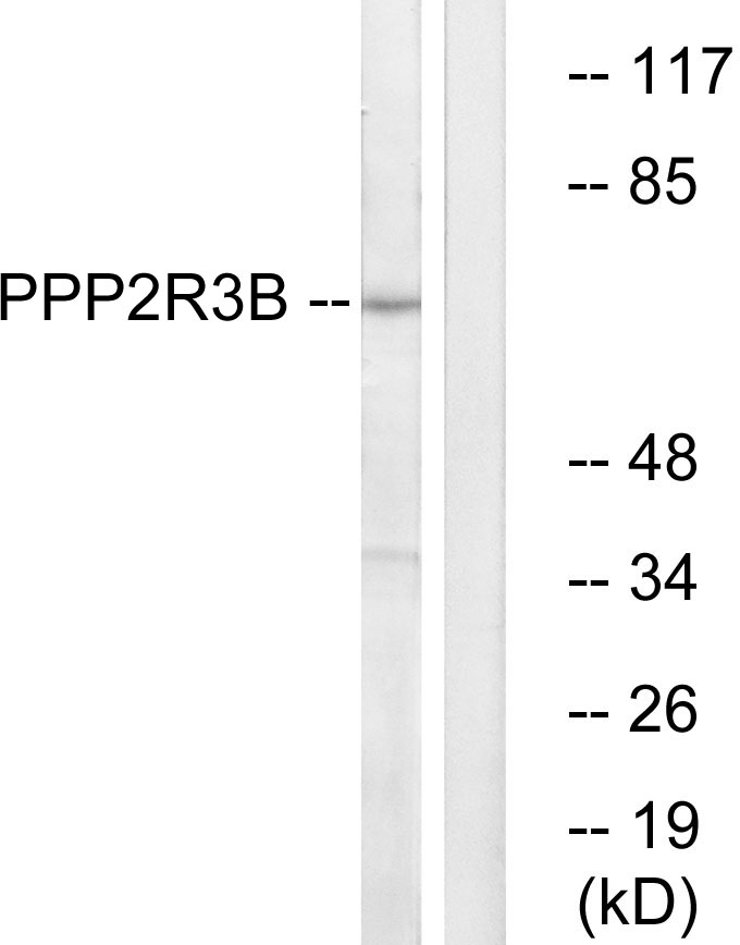 Anti-PPP2R3B Antibody