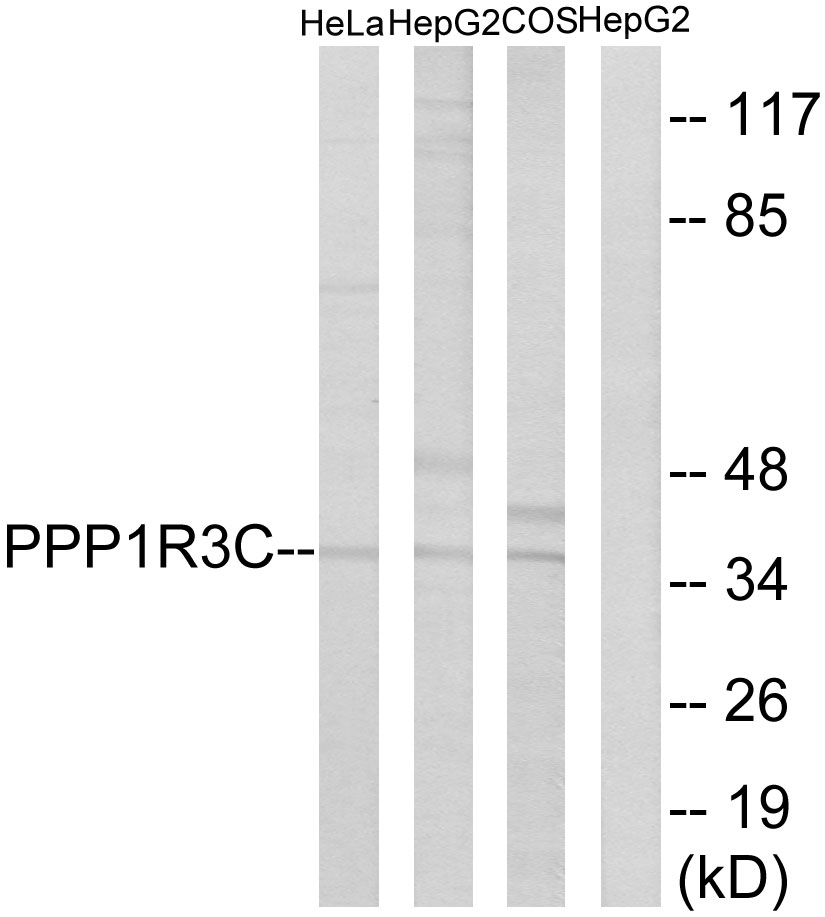 Anti-PPP1R3C Antibody