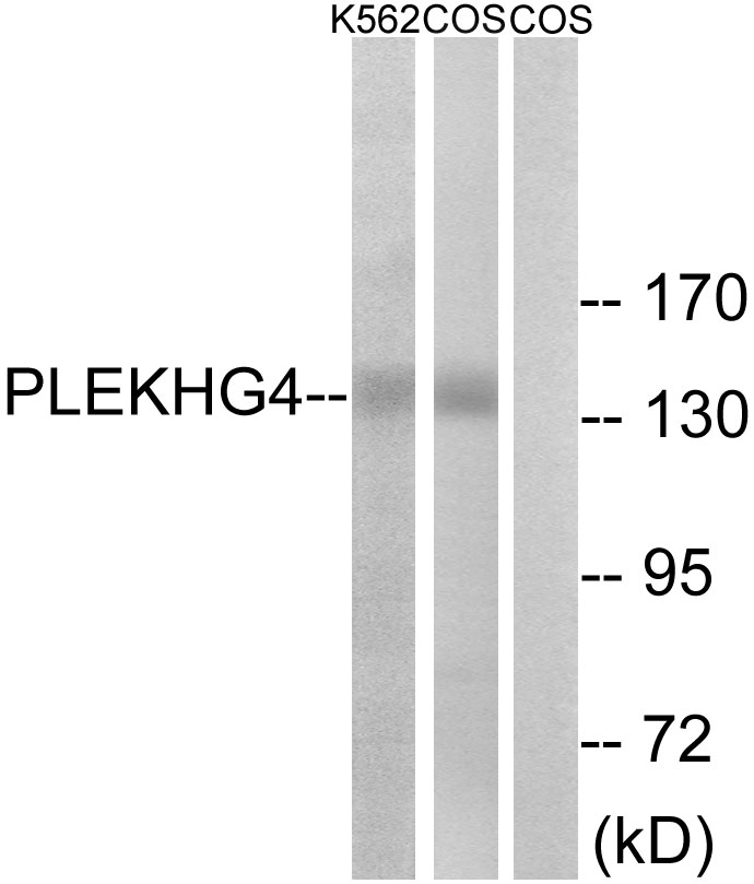 Anti-PLEKHG4 Antibody