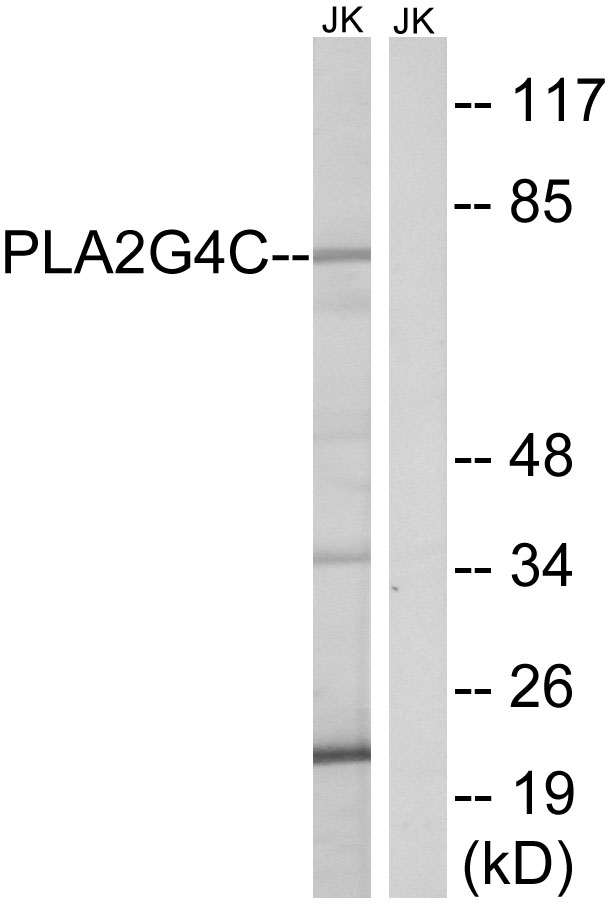 Anti-PLA2G4C Antibody