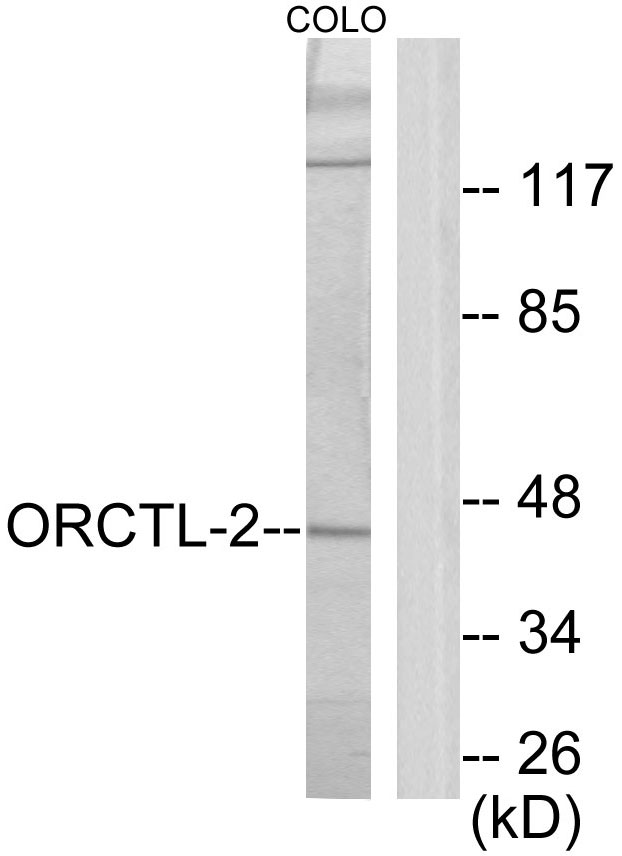 Anti-ORCTL-2 Antibody