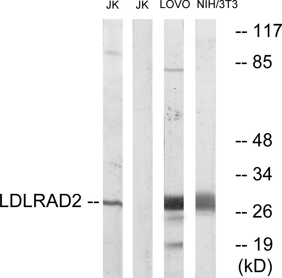 Anti-LDLRAD2 Antibody