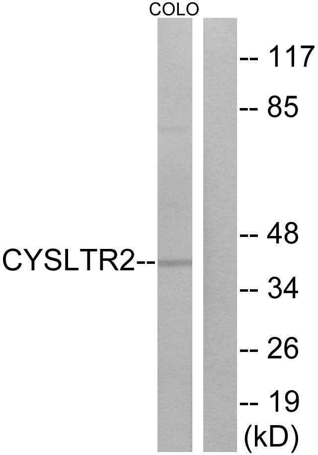 Anti-CYSLTR2 Antibody