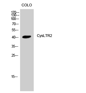 Anti-CYSLTR2 Antibody Anti-CYSLTR2 Antibody