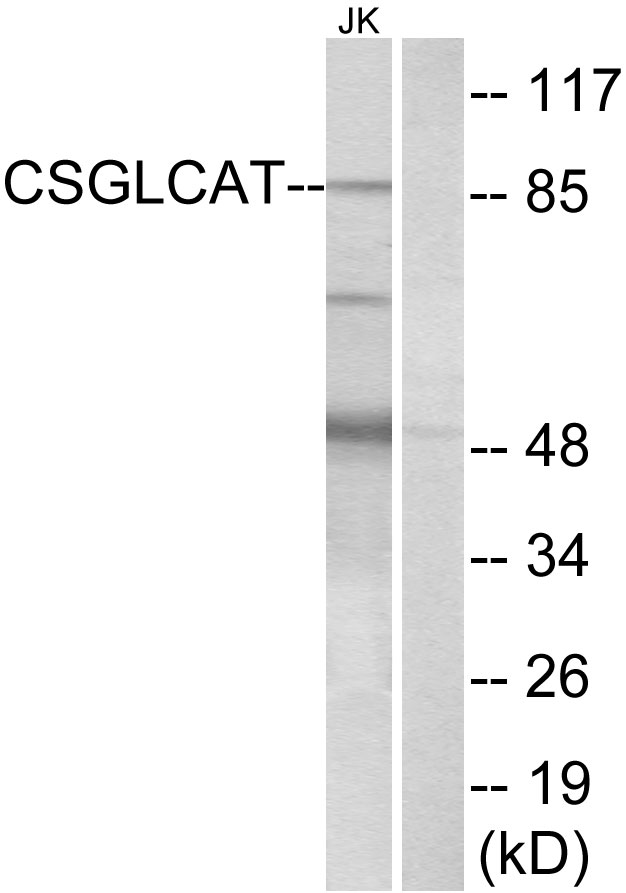 Anti-CSGLCAT Antibody
