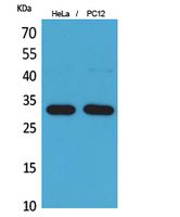 Anti-CD300LF Antibody Anti-CD300LF Antibody