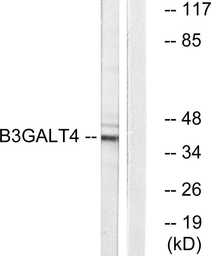 Anti-B3GALT4 Antibody