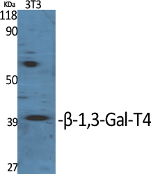Anti-B3GALT4 Antibody Anti-B3GALT4 Antibody
