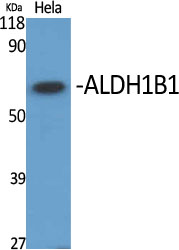 Anti-ALDH1B1 Antibody Anti-ALDH1B1 Antibody