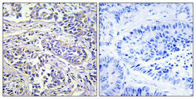 Anti-PLCXD1 Antibody Anti-PLCXD1 Antibody