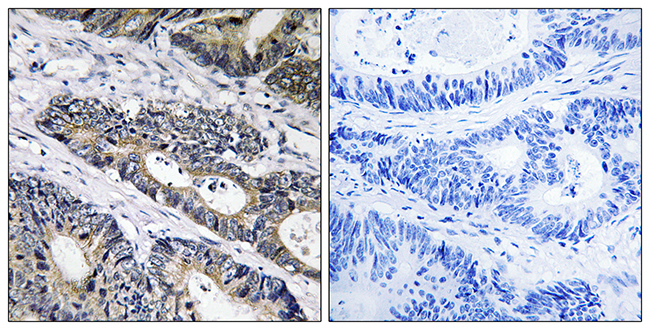 Anti-GLB1L3 Antibody